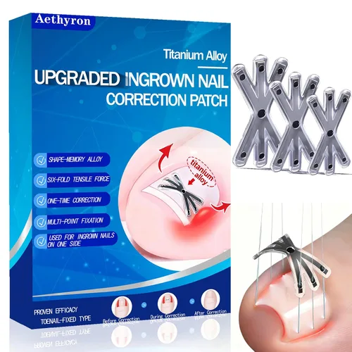 Tratamiento de uñas encarnadas con forma mejorada de 6 ángulos, corrector de uñas encarnadas de aleación de titanio para un alivio rápido, kit de