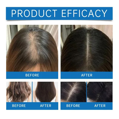 Miniatura 6 de Roll-On para el crecimiento del cabello con romero, 0.8 onzas líquidas de suero y tratamiento del cuero cabelludo, cabello más grueso y lleno