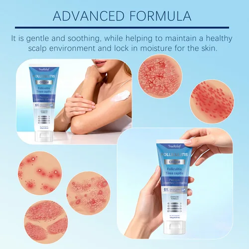 Miniatura 7 de Crema de foliculitis Alivia y ayuda a eliminar protuberancias en el cuero cabelludo, la cara, el cuerpo y los glúteos para pelos encarnados