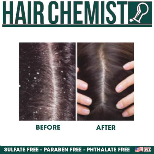 Miniatura 4 de Hair Chemist Champú de menta para cuero cabelludo seco y alivio antipicazón, 33.8 onzas. Fórmula nutritiva que calma el cuero cabelludo irritado