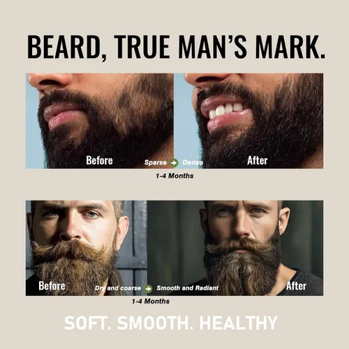 Miniatura 5 de Biotin - Juego de 2 aceites para barba sin perfume y sándalo mezclado con aceite de ricino y semillas de uva para una barba más gruesa, suave e