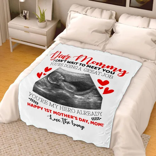 Miniatura 3 de Manta de fotos personalizada con ecografía para padres, manta de ultrasonido para primera vez, mamá y papá, imagen de ecograma personalizada única