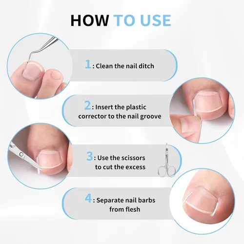 Miniatura 6 de Kit de eliminación de uñas encarnadas, tiras alisadoras de uñas sin dolor, 60 piezas, levantador de uñas y tijeras pequeñas, juego de corrector