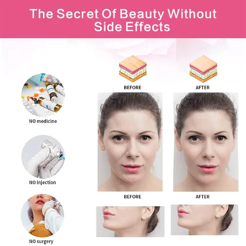 Miniatura 5 de Vendaje elástico para adelgazar la cara V Line Face Shaper mujeres barbilla mejilla elevación cinturón facial anti arrugas correa cuidado facial