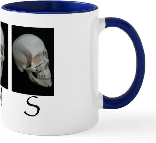 Miniatura 9 de CafePress OMS - Taza quirúrgica con diseño de calavera de 11 oz (11.0 fl oz)
