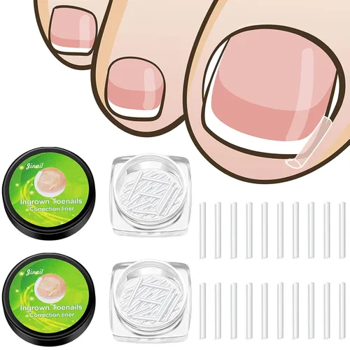 100 tiras correctoras de uñas encarnadas, parches de corrección de uñas de los pies, parches curvos para enderezar las uñas de los pies, clips de