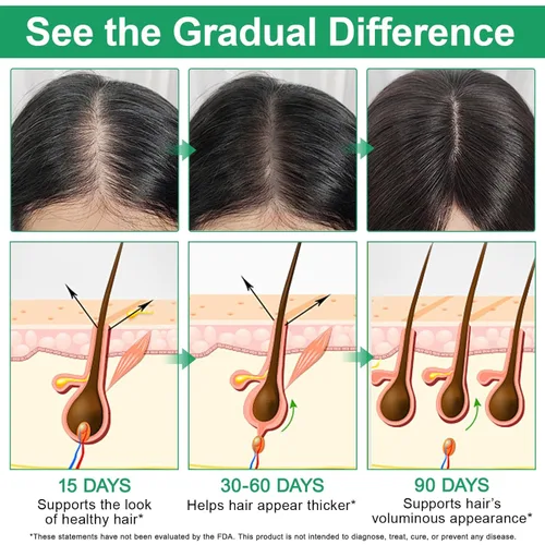 Miniatura 5 de Suero para el crecimiento del cabello roll-on con 3% de romero y redensyl, 2% AnaGain, tratamiento profesional para el crecimiento del cabello