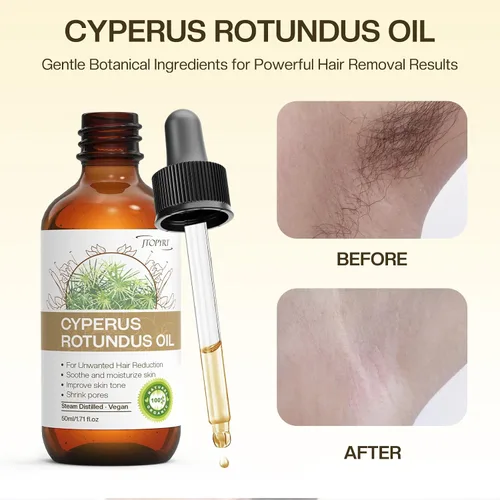 Miniatura 4 de Aceite Cyperus Rotundus: Depilación Aceite de ciprés Reductor del Crecimiento del Cabello Facial Cuerpo Cuidado de la Piel para Mujeres Hombres 2