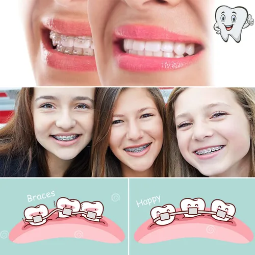 Miniatura 7 de VEZE Soportes dentales, 5 juegos de 100 piezas Mini Roth 022 ranura 345 ganchos, unido, compatible con MBT, unisex, uso en interiores, tema de salud
