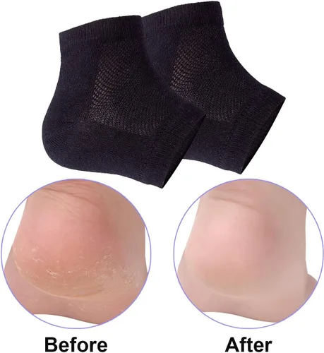 Miniatura 6 de Calcetines de talón de gel hidratantes ventilados, 3 pares de calcetines de spa sin dedos para tratamiento de cuidado de pies, talones agrietados