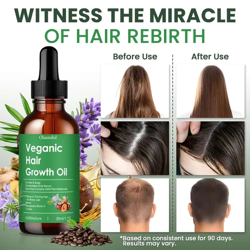 Miniatura 6 de Aceite para el crecimiento del cabello con aceite de ricino de romero, fórmula fortalecedora vegana para adelgazar el crecimiento del cabello