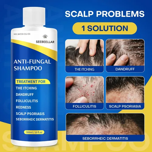 Miniatura 2 de Champú de psoriasis Dermatitis seborreica Antifúngico anticaspa Champú foliculitis copos Tratamiento del cuero cabelludo para hombres y mujeres