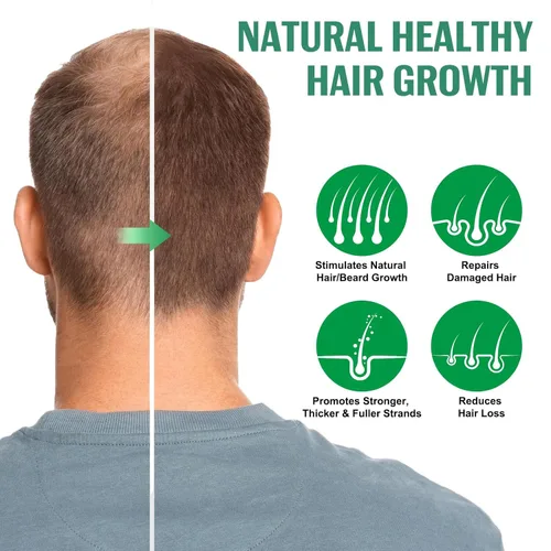 Miniatura 4 de Spray de suero para el crecimiento del cabello, spray natural para el crecimiento del cabello con biotina, batana, romero y aceite de ricino