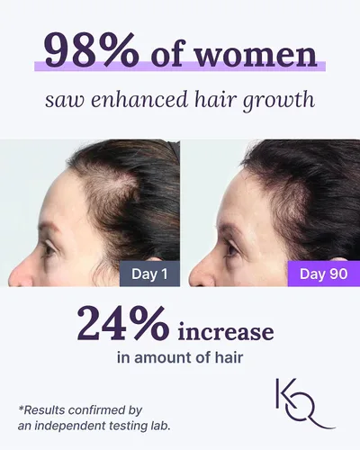 Miniatura 2 de Keranique Suplementos para el cabello y el cuero cabelludo - Promueve la fuerza y el crecimiento. Lo mejor para el cabello fino. Nutre con biotina