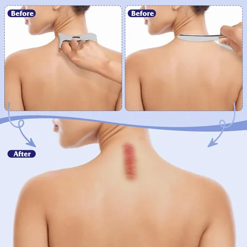 Miniatura 5 de Herramienta de masaje Guasha, herramienta de raspado de acero inoxidable de grado para mejorar tejidos blandos fisioterapia, se utiliza