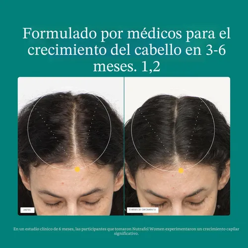 Miniatura 4 de Nutrafol - Suplementos de crecimiento del cabello para mujeres, edades 18-44, clínicamente probados para cabello visiblemente más grueso y fuerte