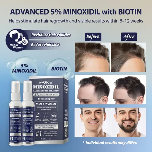 Miniatura 3 de TruGlow - Spray de tratamiento de crecimiento del cabello de minoxidil al 5% para hombres y mujeres con cabello delgado, solución tópica