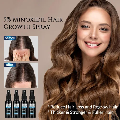 Miniatura 4 de Minoxidil al 5% para barba y cabello para hombres, minoxidil para mujeres en aerosol para el crecimiento del cabello con biotina y aceite de ricino