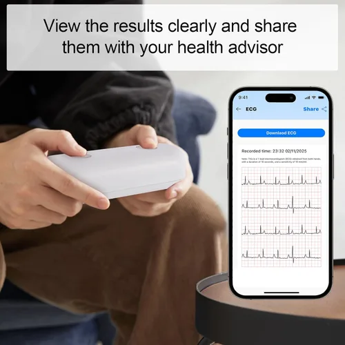 Miniatura 3 de Monitor portátil de ECG Registre y almacene señales de ECG de una sola derivación Monitorear y mostrar la frecuencia cardíaca para uso
