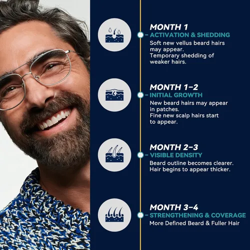Miniatura 5 de Minoxidil para hombres Suero para el crecimiento de la barba: Extra Strength 5% Minoxidil Spray para hombres Tratamientos de crecimiento de barba