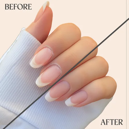 Miniatura 6 de C CARE Aceite en Roll-On para Cutículas Sin Fragancia Aceite Hidratante Natural Revitalizante para Uñas Repara Cutículas Durante la Noche Para