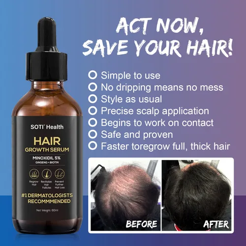 Miniatura 6 de Suero tópico para el crecimiento del cabello de minoxidil al 5% para hombres y mujeres, suero para el crecimiento del cabello para la pérdida