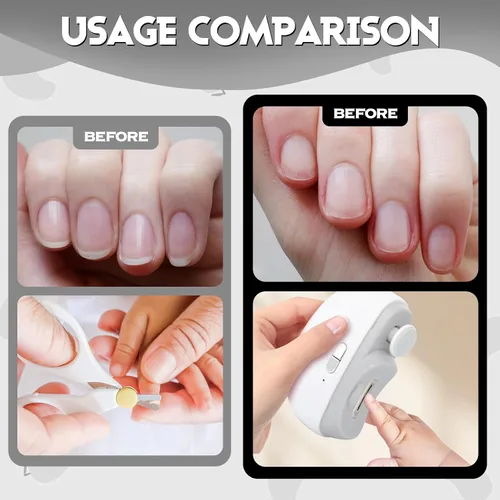 Miniatura 3 de Cortaúñas eléctrico para personas mayores, 3 en 1, cortaúñas automático eléctrico con luz LED y almacenamiento de clips, recortadora de uñas