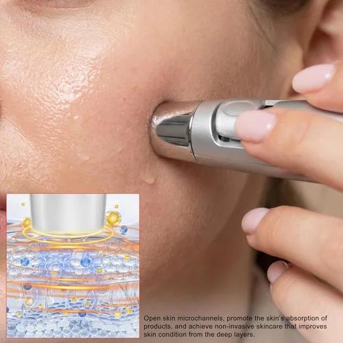 Miniatura 4 de Elitzia ETF49E Dispositivo facial de electroporación sin aguja, máquina de belleza facial importadora de iones de mesoporación, eliminación