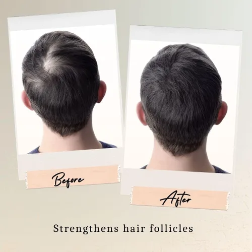 Miniatura 4 de Suero para el crecimiento del cabello con vitamina E, cúrcuma y aceite de argán, tratamiento orgánico para el cuero cabelludo seco para mujeres