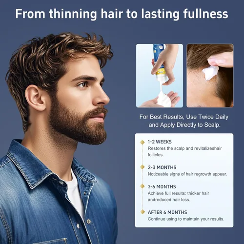 Miniatura 6 de Espuma de minoxidil, 5% de espuma tópica de minoxidil, infundida con biotina, tratamiento para el crecimiento del cabello, minoxidil para hombres