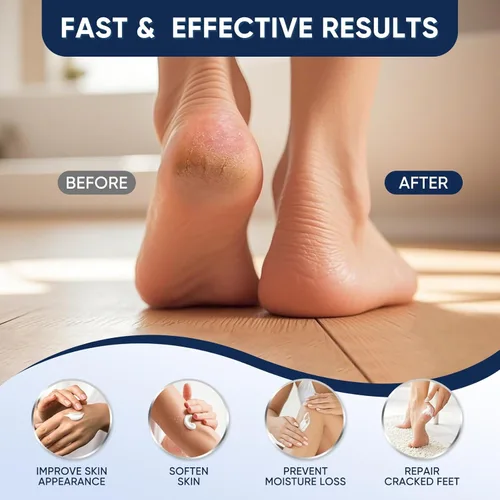 Miniatura 3 de Crema de urea 40 por ciento para pies de máxima resistencia, crema de urea 40% más ácido salicílico 2%, crema para pies y manos para piel seca