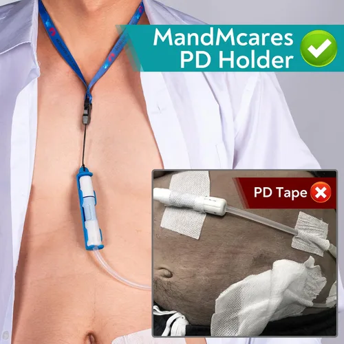Miniatura 2 de Soporte patentado de transferencia de diálisis peritoneal para Baxter, accesorios para cinturón de soporte de catéter PD Azul