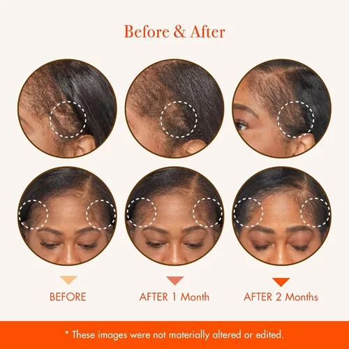 Miniatura 5 de RED by Kiss Aceite fortalecedor del cabello con aceites orgánicos 100% naturales y certificados por USDA para el crecimiento del cuero cabelludo