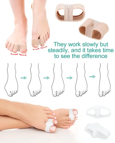 Miniatura 5 de 4 separadores de dedos correctores de juanetes para mujeres y hombres, espaciadores de gel para dedos grandes con 2 bucles para pies, alisador