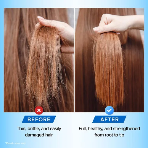 Miniatura 6 de Biotin - Juego de champú y acondicionador para el crecimiento del cabello, sin sulfatos, acondicionador profundo para cabello seco dañado, fabricado