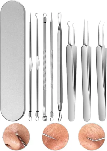 Kit de eliminación de puntos negros de acero inoxidable, kit de herramientas para reventar espinillas, pinzas removedoras de puntos negros,