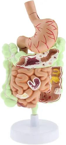 KESOTO Modelo de Patología Gastrointestinal Humana Modelo Coronal Gástrico del Tracto Digestivo para Estudiantes Escolares Aprendizaje
