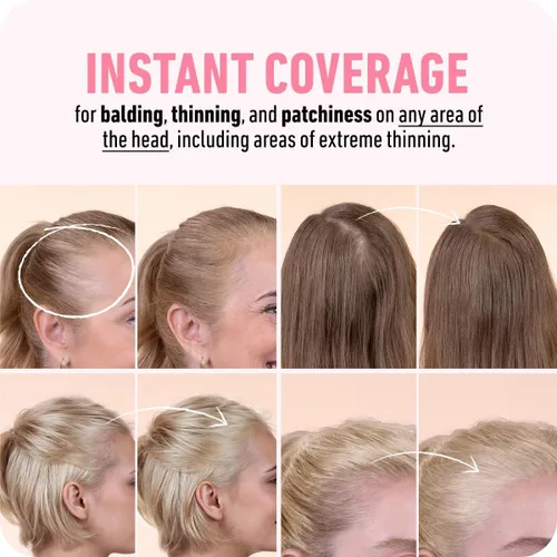 Miniatura 4 de BOLDIFY Polvo de línea capilar (GRANDE, 10g) - Color de cabello para retoque de raíces para cobertura de canas - Polvo para el cabello que oculta