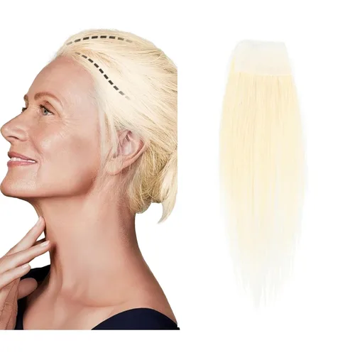 Miniatura 21 de Reemplazo de cabello humano con cicatrices, quemaduras accidentales sin vello para hombres y mujeres, pérdida de línea de cabello, cinta recta