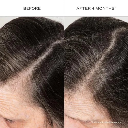 Miniatura 4 de Zenagen Suero engrosante para el cabello