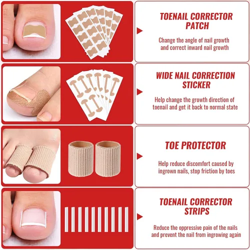Miniatura 5 de Kit de eliminación de uñas encarnadas, kit de herramientas de uñas encarnadas con corrector de uñas encarnadas, gotas de uñas encarnadas, parche