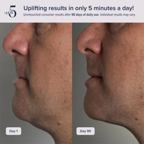 Miniatura 4 de Elevación facial pulsante Dispositivo de reversión de edad de 5 minutos, contornea y mejora las estructuras faciales, tensando y tonificando