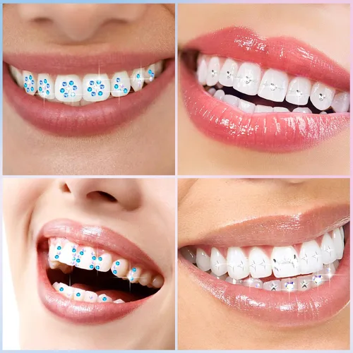 Miniatura 4 de Sosation Kit de 377 piezas de gemas de dientes para mujer, kit de joyería de dientes de moda de cristal artificial, juego de iniciación de gemas