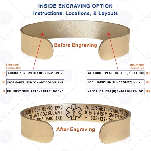 Miniatura 14 de Pulsera de identificación de alerta médica, acero inoxidable 316L, personaliza y personaliza, selecciona un tamaño de muñeca, de 6 a 9 pulgadas