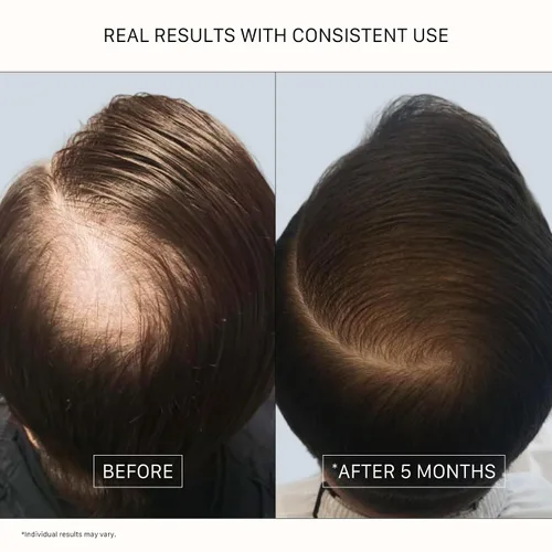Miniatura 5 de ACTIIV Recover - Tratamiento de champú engrosante para hombres Apoya la apariencia de un cabello más completo y de aspecto más saludable, apoya