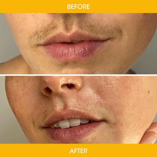Miniatura 5 de Nad's Tiras de cera facial