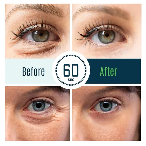 Miniatura 9 de Tratamiento de ojos hinchados Time Reverse Instant Anti-aging Eye Cream Nueva fórmula avanzada - Reduce visiblemente las bolsas debajo de los ojos