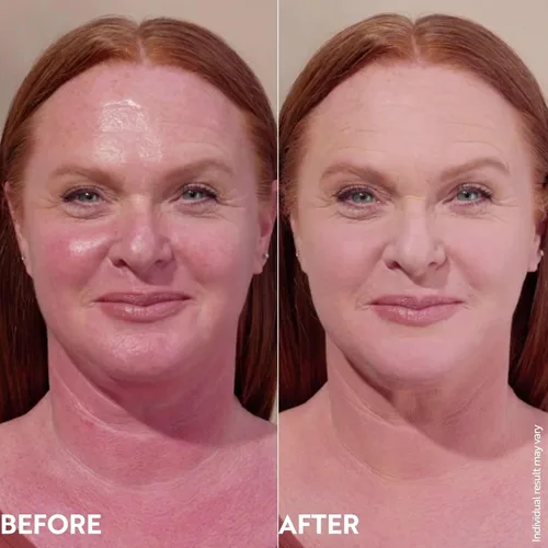 Miniatura 10 de Crema Ligera para rellenar arrugas – Reduce la apariencia de arrugas, enrojecimiento, de manchas e imperfecciones – Acabado mágico para brillos