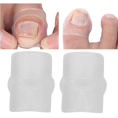 Corrector de uñas encarnadas, 2 piezas de herramienta de corrección de uñas encarnadas de silicona, corrector de uñas encarnadas, tratamiento de