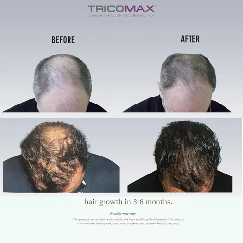 Miniatura 8 de Tricomax Suplemento para el crecimiento del cabello, apoya el cabello más grueso, más lleno y reduce la caída, ingredientes clínicamente estudiados